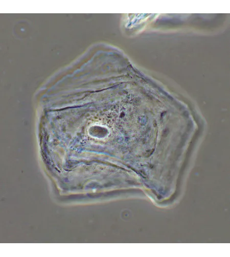 Фазово-контрастное устройство MAGUS SPH2