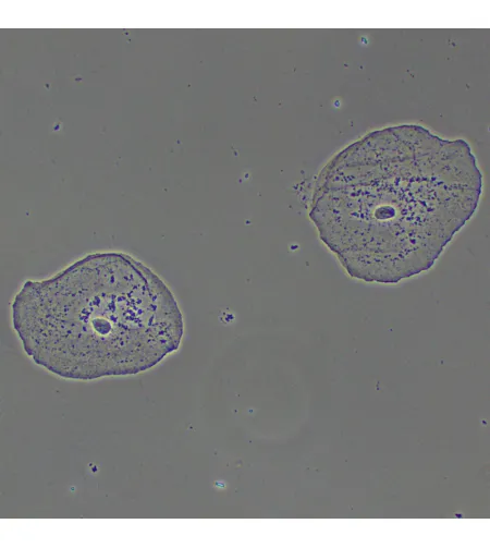Фазово-контрастное устройство MAGUS PH2