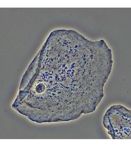 Фазово-контрастное устройство MAGUS PH2