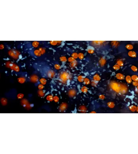 Камера для микроскопа BRESSER MikroCamII 9MP 4K 1 дюйм